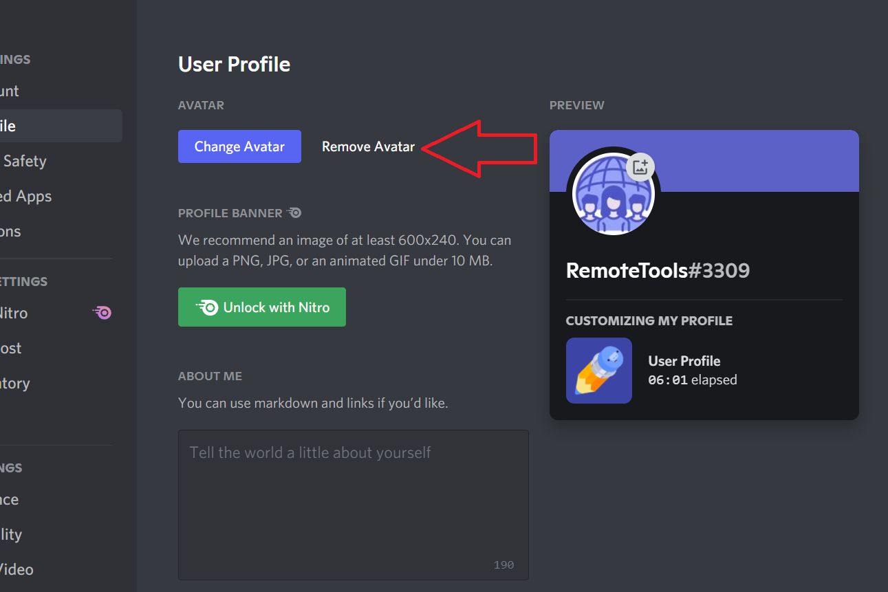 Discord changes